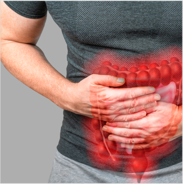 Nutricao na doenca inflamatoria intestinal