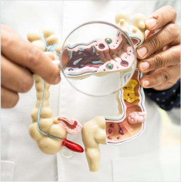 Nutricao nas doencas funcionais do intestino