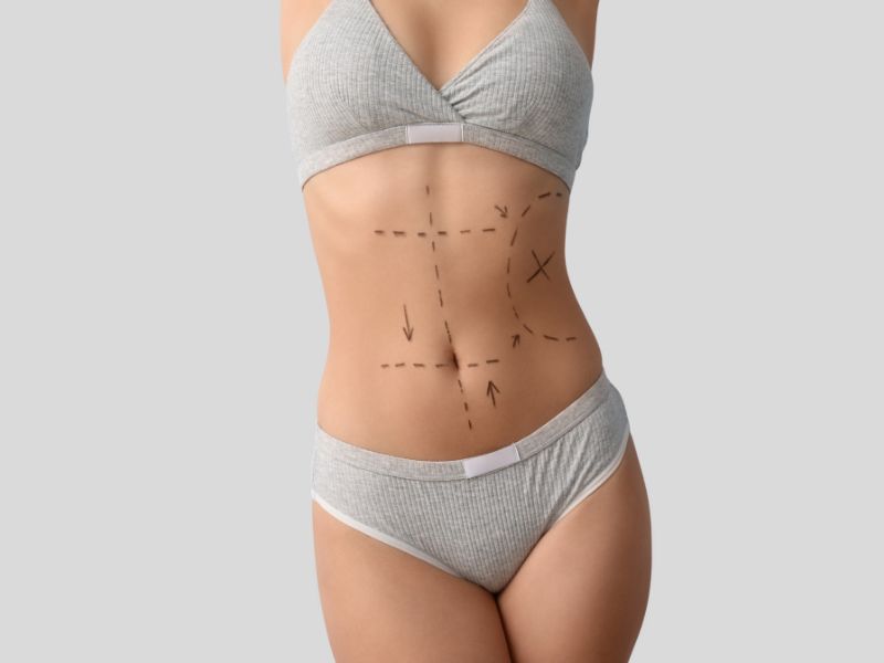Plano alimentar para cirurgia plastica em Curitiba