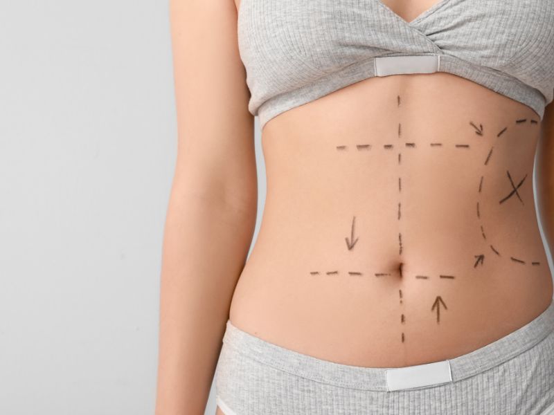 Tratamento nutricional para cirurgia plastica em Curitiba